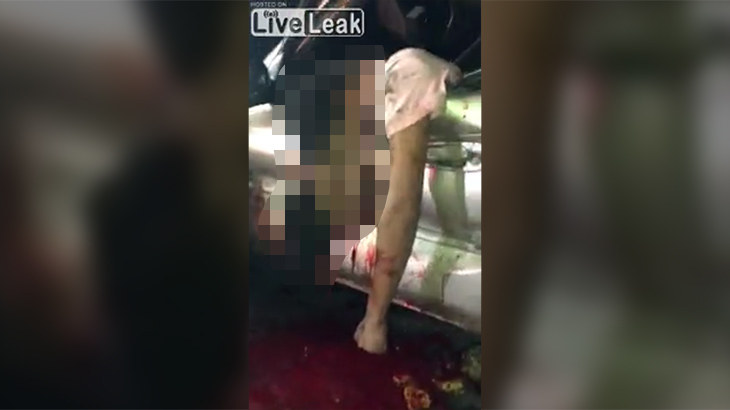 【超！閲覧注意】とんでもない顔になってしまった事故映像があまりにもグロい･･･。