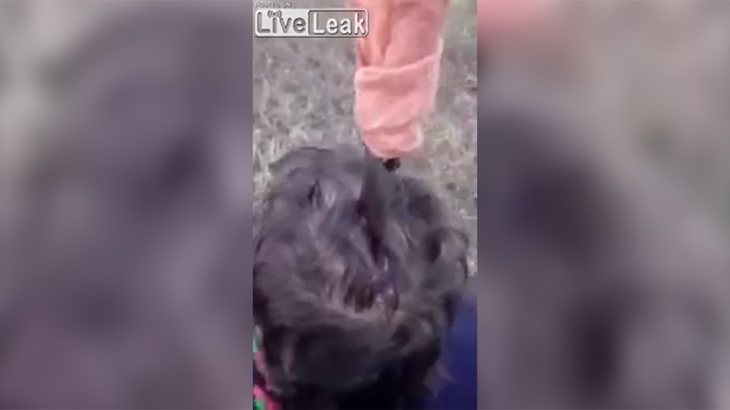 【グロ動画】精神病患者がとんでもない理由で自分の頭にナイフを突き刺してしまう。