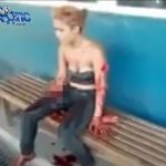 【閲覧注意】切断された自分の右腕を持ち歩く女性のグロ動画。