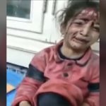 爆撃を受けたシリアの少女「もう歩けないの？」と涙を流す。