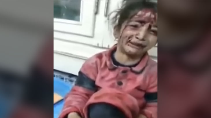 爆撃を受けたシリアの少女「もう歩けないの？」と涙を流す。