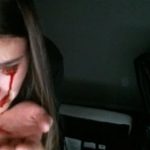 【閲覧注意】ペットの猫に目を傷つけられ流血する女の動画。