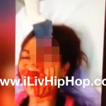 【閲覧注意】包丁が目に刺さった女性、まだ生きているグロ動画。