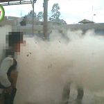 【閲覧注意】戦地にて砲撃を受けて顔を壊されてしまうグロ動画。