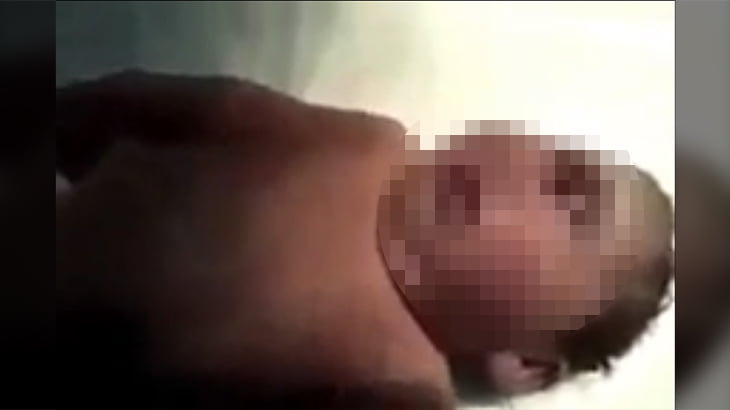 【閲覧注意】目が1つしかない、まだ生きている赤ちゃんのグロ動画。