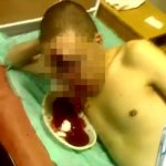 【閲覧注意】ライフルで自殺を試みた男性、死ねずにとんでもない姿になってしまったグロ動画。