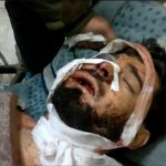 【閲覧注意】スナイパーに狙撃された男性、右頬を抉られてしまうグロ動画。