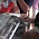 【閲覧注意】製麺機に手を挟まれグチャグチャになってしまったグロ動画。