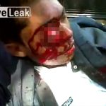 【閲覧注意】バイク転倒した男性、右目が飛び出てしまったグロ動画。