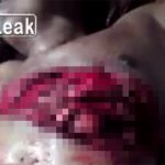 【超！閲覧注意】事故で心臓がむき出しになってしまった男のグロ動画2本。