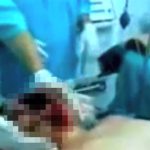 【超！閲覧注意】顔が縦にパックリ割れてしまう男性、まだ生きているグロ動画。