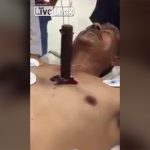 【衝撃映像】心臓近くに刺さったナイフ、鼓動に合わせてピクピク動くグロ動画。