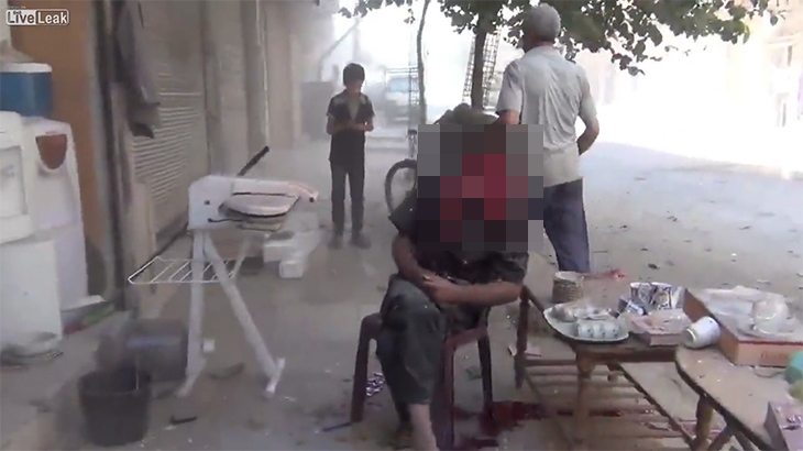 【閲覧注意】爆撃を受けた男性、おそらく死んだことにも気づいていないグロ動画。