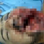 【超！閲覧注意】ショットガン自殺に失敗した男、アゴが砕けてしまったグロ動画。