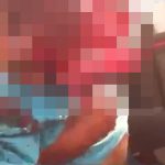 【超！閲覧注意】頭の中身がごっそり無くなってしまった男のグロ動画。