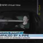 【閲覧注意】顔にフェンスのポールが突き刺さってしまったグロ動画。