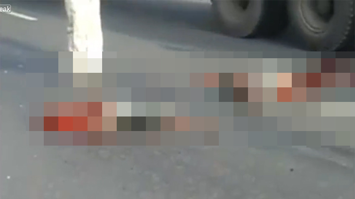 【閲覧注意】事故で上半身だけになってしまった男、まだ動いているグロ動画。