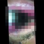 【閲覧注意】口の中がウジ虫の棲家と化してしまった男のグロ動画。