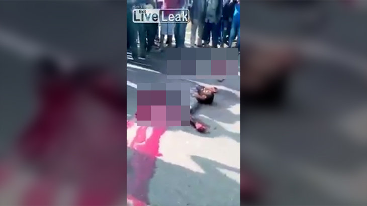 【超！閲覧注意】上半身だけになってしまった男、めちゃくちゃ動き回るグロ動画。