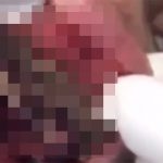 【閲覧注意】子供の口の中、虫の棲家になってしまったグロ動画。