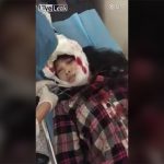 【閲覧注意】事故に遭った女性、頭皮がペロンと剥がれてしまったグロ動画。