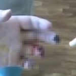 【閲覧注意】合成麻薬「クロコダイル」で体が壊死した人々のグロ動画。