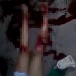 【閲覧注意】事故に遭った女性の脚、脛でポッキリ折れてしまったグロ動画。