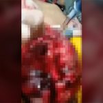 【閲覧注意】バーで喧嘩した男性、口の中がグチャグチャになってしまったグロ動画。