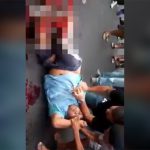 【閲覧注意】バスのタイヤを蹴った少年の足、弾け飛びグチャグチャに。