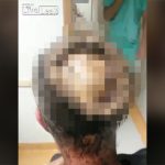 【閲覧注意】もうなんでこうなったのか分からない人間の頭部を撮影したグロ動画。