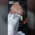 【閲覧注意】左目が「とある生き物」に食われてしまった女性のグロ動画。