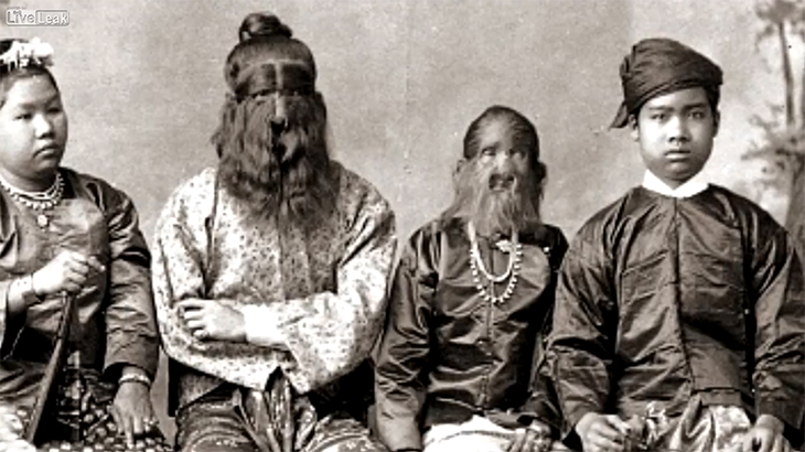 【閲覧注意】かつて見世物小屋で働いていた奇形の人々。