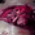 【超！閲覧注意】マチェテで胸を切り裂かれた男、心臓が丸見えになったグロ動画。