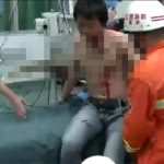 【閲覧注意】竹が胸に刺さった男性、奇跡的に心臓を回避。