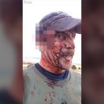 【閲覧注意】クマに襲われ血まみれになった直後、その様子をFacebookにアップする男。