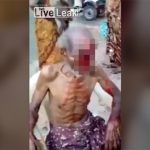 【閲覧注意】野良犬に顔を剥ぎ取られてしまった90歳のおじいちゃんのグロ動画。