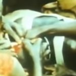 【閲覧注意】アフリカの脳外科手術。かなり昔のグロ動画。