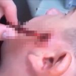 少年のコメカミから長くてビロビロしたものが出てくる動画。