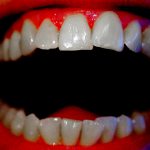 【閲覧注意】歯茎が腐ってしまった老人、歯を抜いてみると･･･。