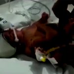 【衝撃映像】4本の足を持ち、2本のペニスを持って生まれた赤ちゃん。