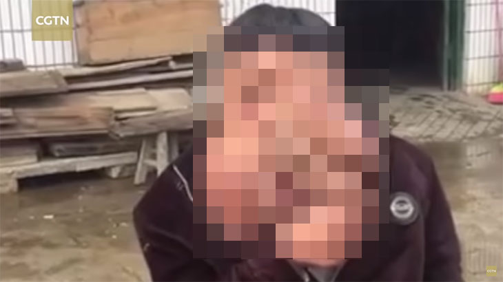 【閲覧注意】まるで “ぬらりひょん” 。顔に巨大な腫瘍を持つ中国の男性。