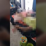 【閲覧注意】毒を飲んで自殺した女性、その5日後の様子。