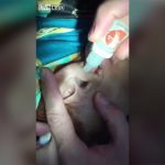 【衝撃映像】少女の耳の中からとんでもない生き物が這い出てくるグロ動画。