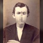 【閲覧注意】第一次世界大戦で顔を負傷した人々のグロ動画。