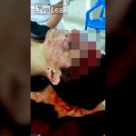 【超！閲覧注意】顔が “割れてしまった” とんでもない状態のグロ動画。