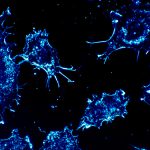 【閲覧注意】”顔に癌を発症” した女の子。苦しむ様子が見ていられない。