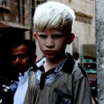 【閲覧注意】皮膚ガンにより、頭の1／4が腐ってしまったグロ動画。