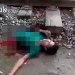 【閲覧注意】胴体が真っ二つになっても “まだ生きている状態” にだけはなりたくない。