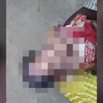 【閲覧注意】インドで生まれた、およそ “20万人に1人” と言われる赤ちゃんのグロ動画。