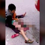 【閲覧注意】泣き叫ぶ男の子の声。近づいてみるとその足が･･･。